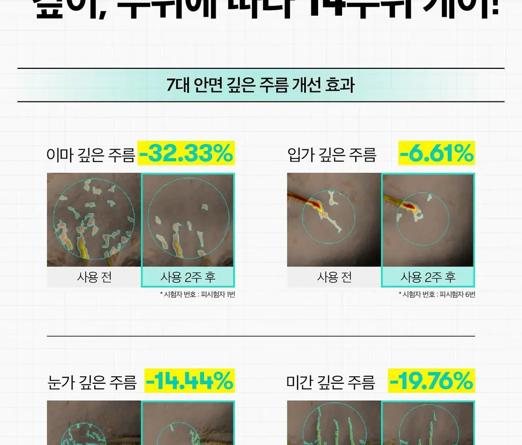 [아이크림/눈가탄력] VT 피디알엔 리들샷 아이 리프터 15ml 상세페이지 20